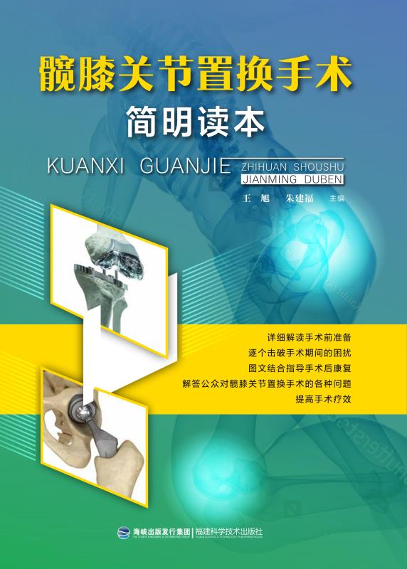 髋膝关节置换手术简明读本