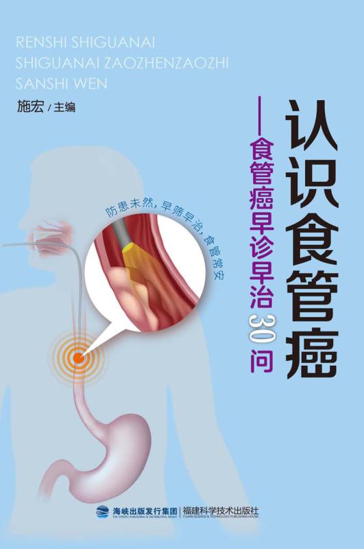 认识食管癌：食管癌早诊早治30问