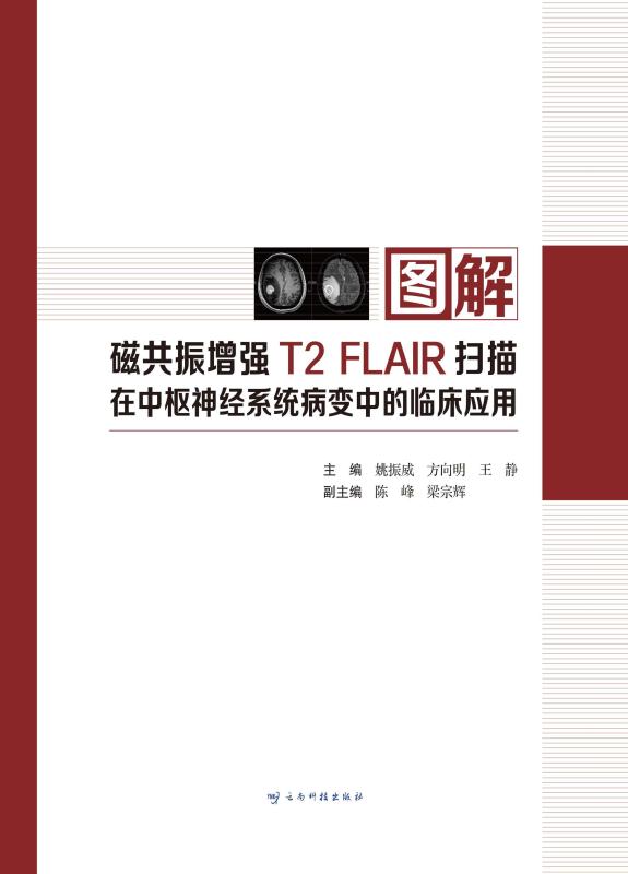 图解磁共振增强T2 FLAIR扫描在中枢神经系统病变中的临床应用