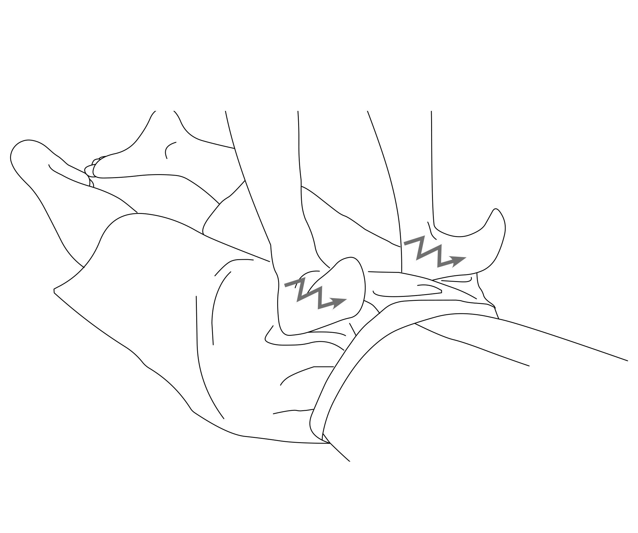 img255