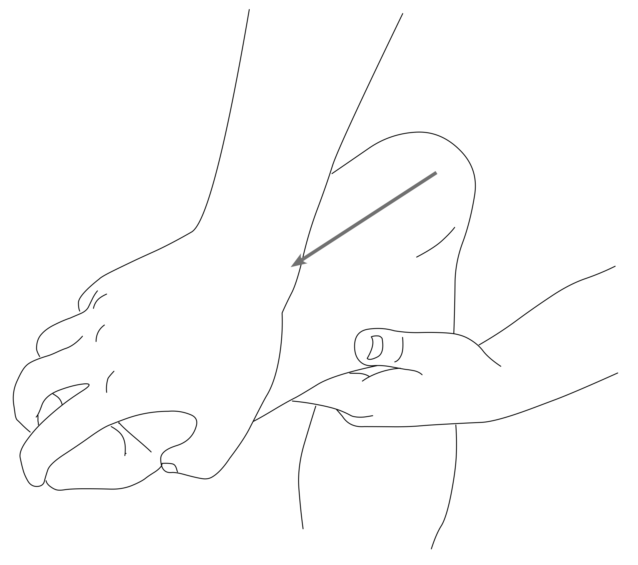 img171