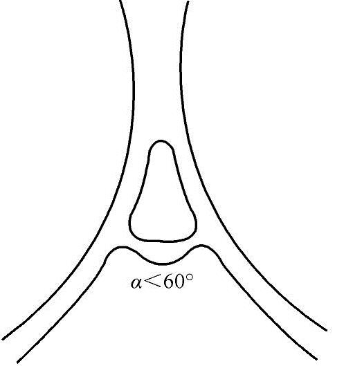 978-7-111-50622-5-Chapter02-2.jpg